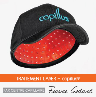 Rajeunissement capillaire au laser Capillus – Centre capillaire France Godard - St-Eustache