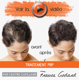 Traitement PRP – Centre capillaire France Godard - St-Eustache